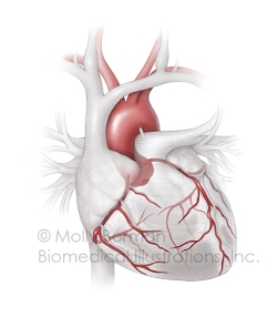 Coronaries